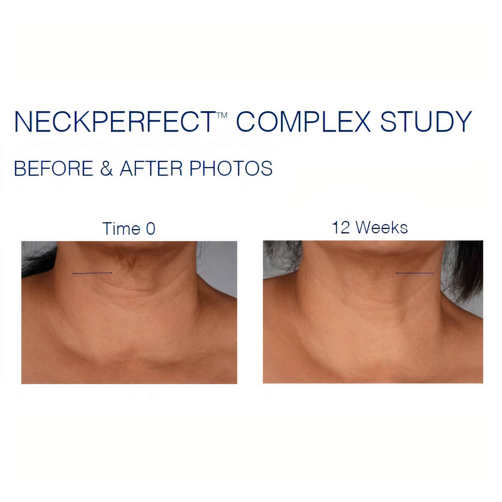 iS Clinical Neck Complex